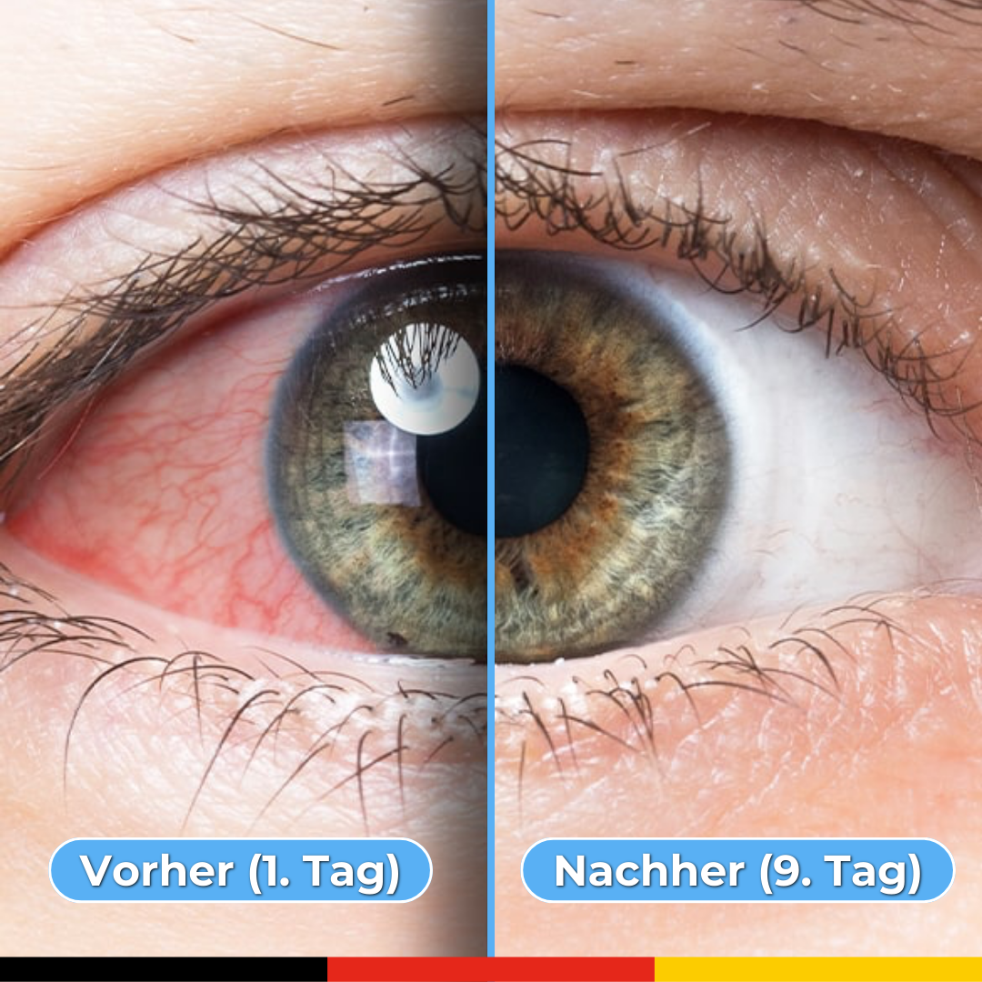 Avero™ - 2 in 1 Dampf & Wärmetherapie